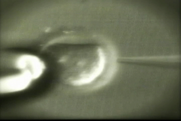 Egg Donors Say They Were Scammed By Boise Fertility Company Ktvb Com